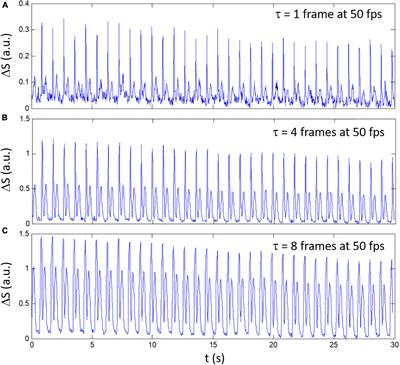 Novel Analysis Method for Beating Cells Videomicroscopy Data: Functional Characterization of Culture Samples